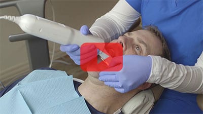 iTero Element GP Patient Video