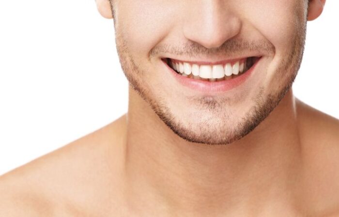 Close up of man smiling dental erosion enamel erosion dentist in Annapolis Maryland
