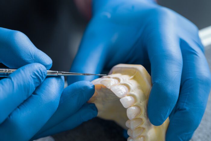 Dentures in Annapolis MD